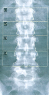 Lendenwirbelsäule