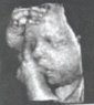 abdominaler Ultraschall des Ungeborenen
